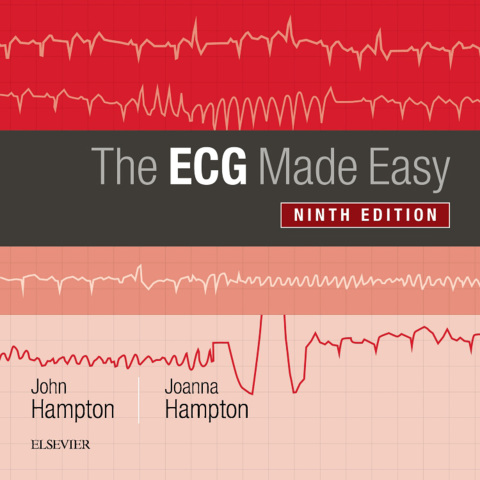The ECG Made Easy